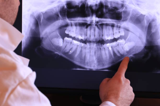 Best Broken or Chipped Tooth Repair in Sugar Grove, IL